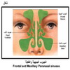 ������ ������� ������� Frontal and Maxillary Paranasal sinuses