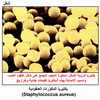 ������� ��������� ��������� (Staphylococcus aureus)